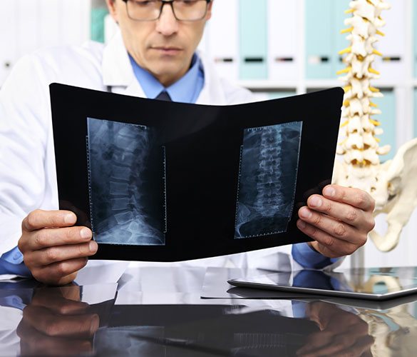 Spinal Surgery